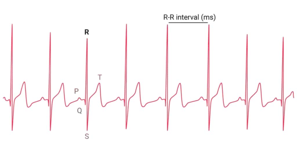 連続する心拍と心拍の間隔